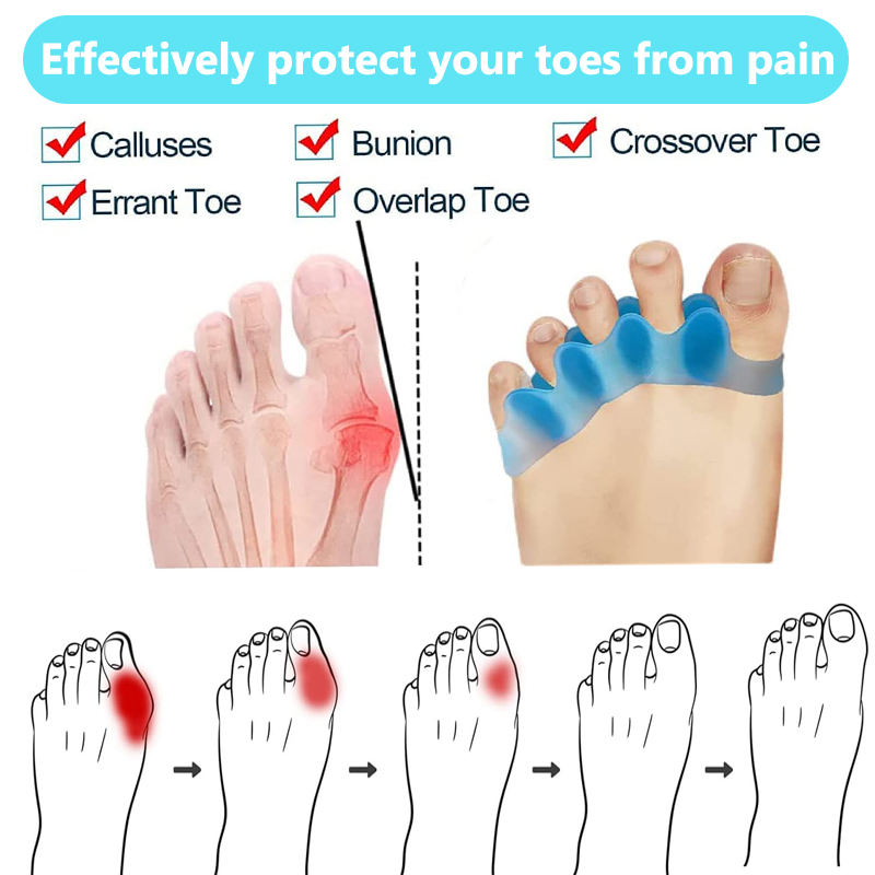 Orthopedic toe separators for walking - podiatrist-approved SEBS gel for bunion prevention